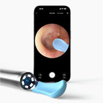 Limpiador de Oídos inteligente con cámara HD, BEBIRD R1 ORIGINAL (Otoscopio)